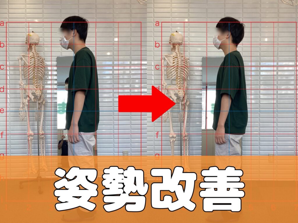 鹿児島市の整体院で姿勢改善した例