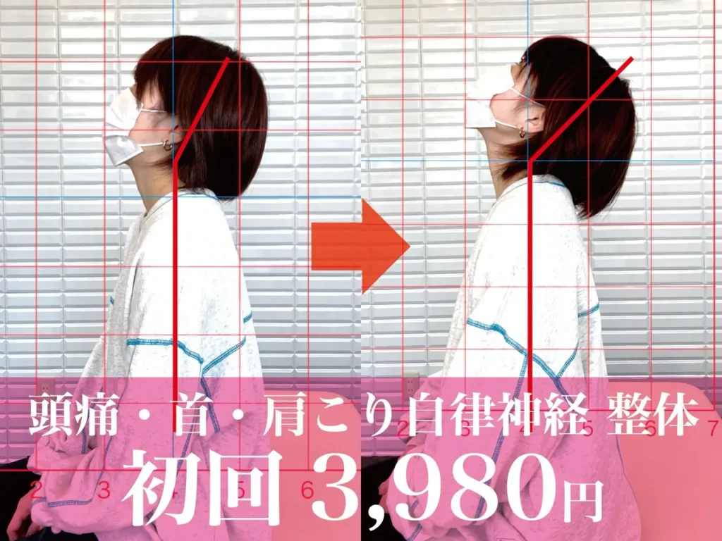 鹿児島整体 首こり ストレートネック 姿勢改善のビフォーアフター