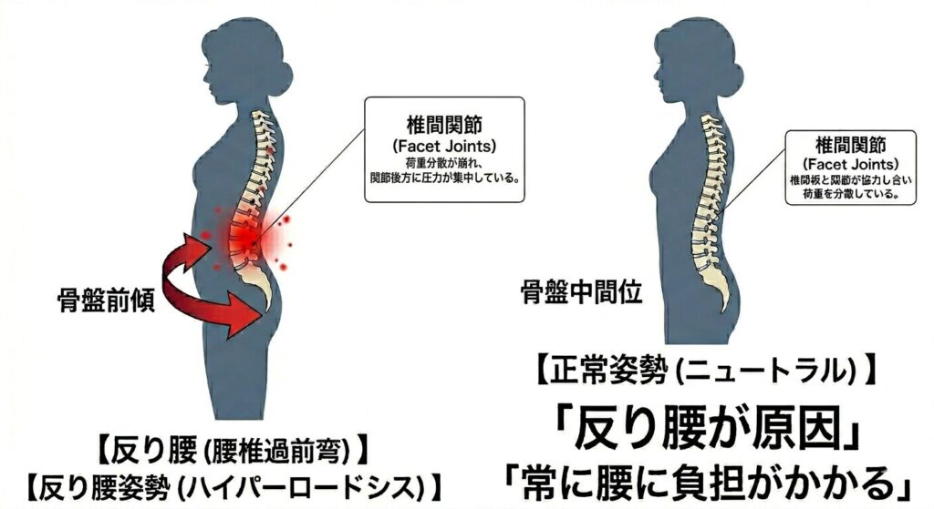 腰だけで反る動きと股関節・胸椎を使う正しい動きの比較図