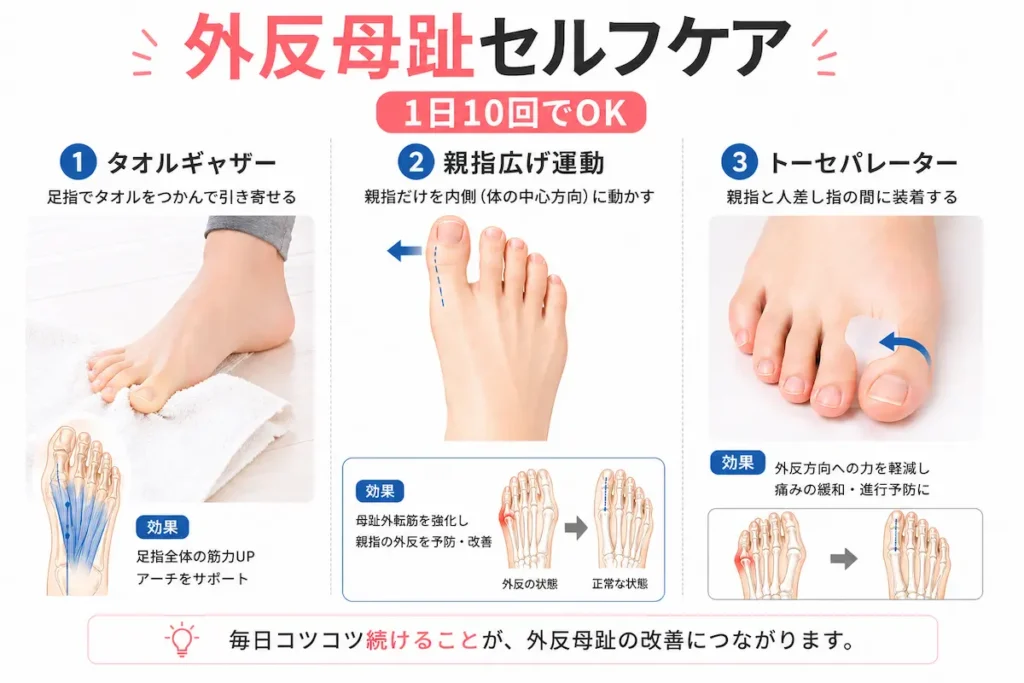 外反母趾のセルフケア（タオルギャザー・親指運動・セパレーター）