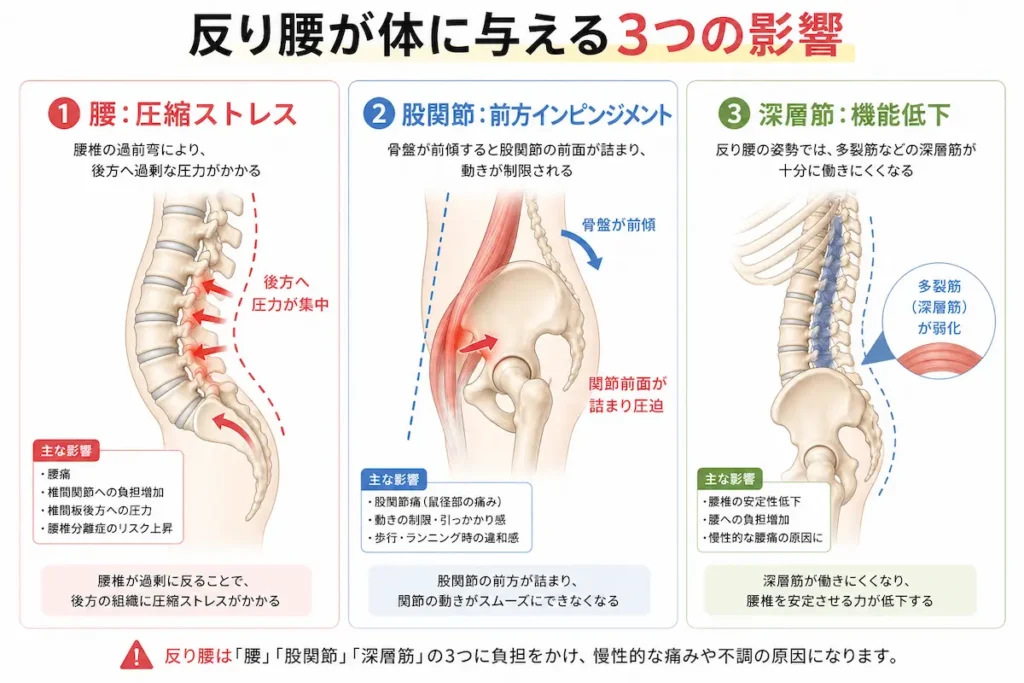 反り腰による腰椎圧迫と股関節の詰まりのメカニズム