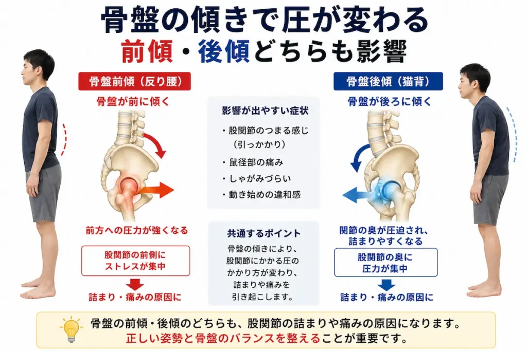 骨盤前傾後傾による股関節の圧力変化