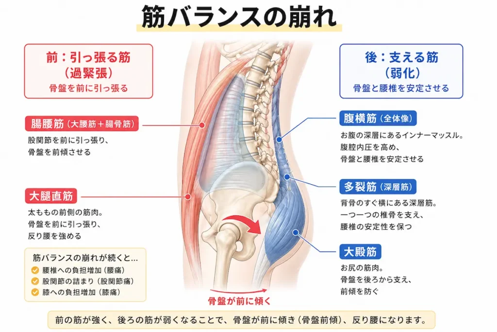 反り腰の原因となる筋肉バランス 腸腰筋と体幹筋の関係