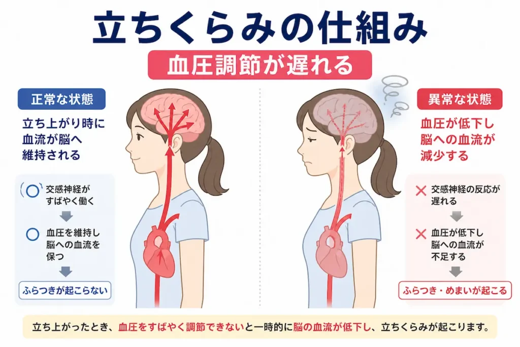 起立時の血圧低下による脳血流減少の仕組み図