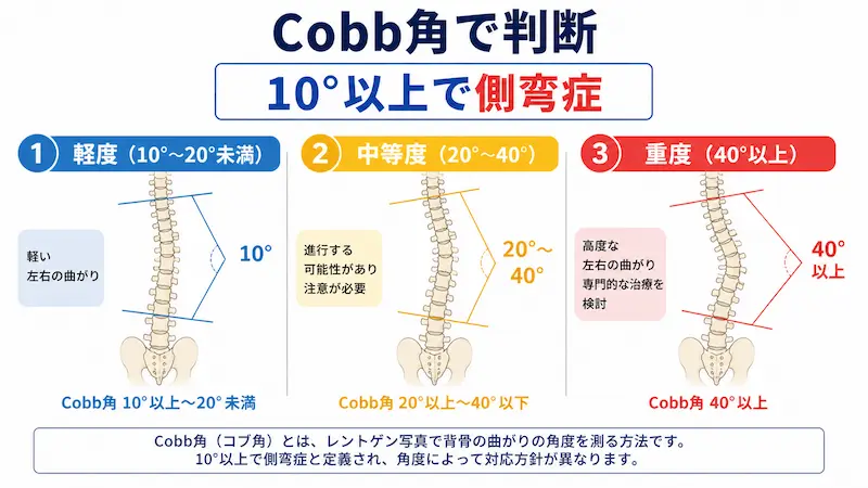 Cobb角 側弯症 角度分類 図解