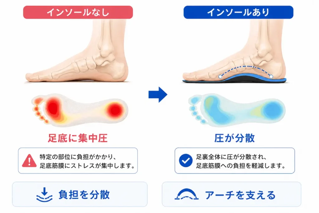 インソールの有無による足底圧の違いとアーチサポートの効果