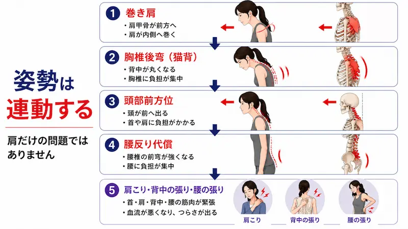 巻き肩と猫背による肩こり・背中・腰の張りの姿勢連鎖図