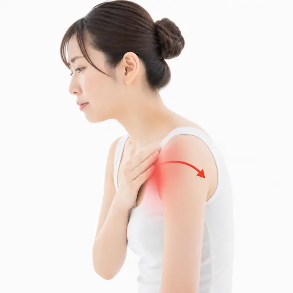 巻き肩で肩が前に出て胸が閉じた姿勢と肩前面の負担イメージ