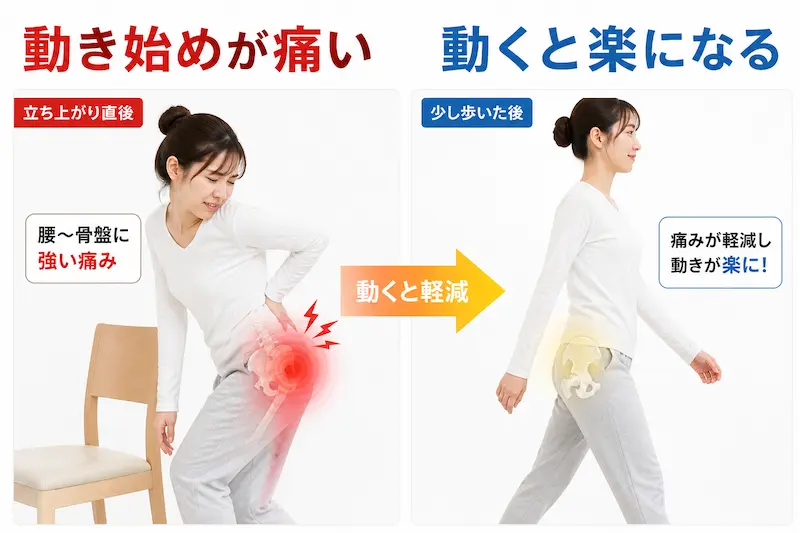動き始めに痛みが強く動いているうちに和らぐ仙腸関節炎の特徴