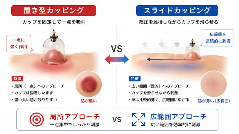 置き型カッピングとスライドカッピングの違いを比較した図解
