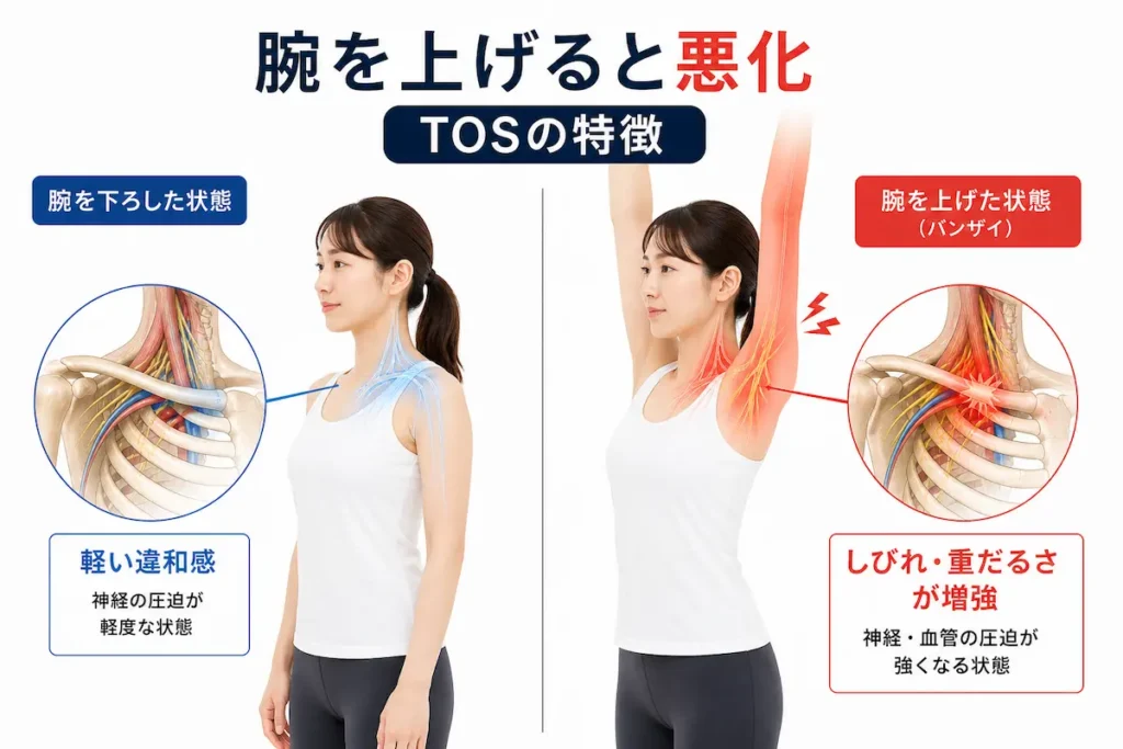 腕を上げるとしびれが悪化する胸郭出口症候群の特徴
