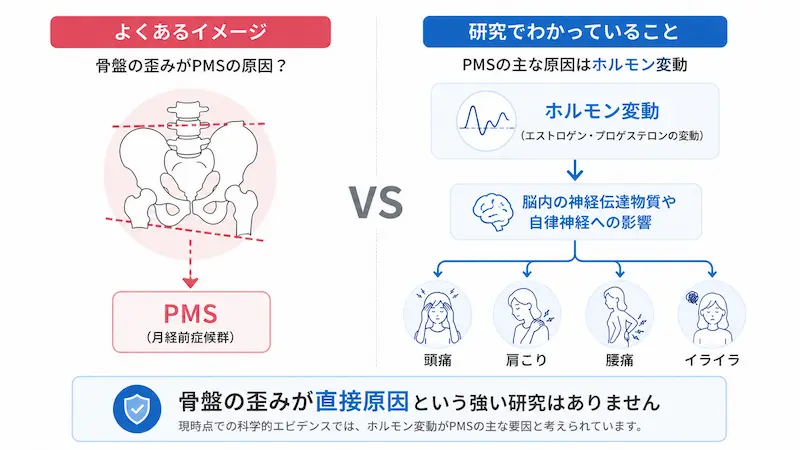 骨盤の歪みとPMSの関係について研究結果と一般的なイメージを比較した図