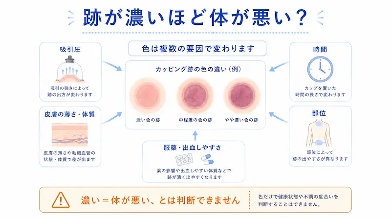 カッピング跡の色が吸引圧や時間、部位、体質、服薬状況で変わることを説明する図解