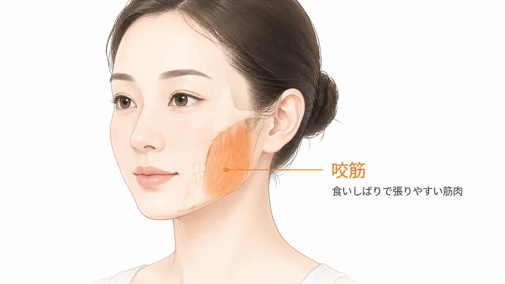 食いしばりで負担がかかりやすい咬筋の位置を示した図