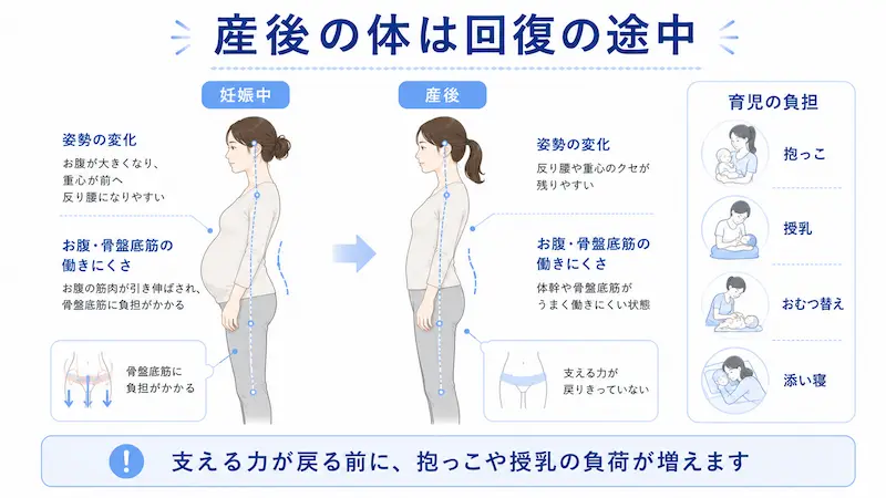 妊娠中の姿勢変化と、産後も反り腰や体幹・骨盤底筋の働きにくさが残る状態を比較した図解