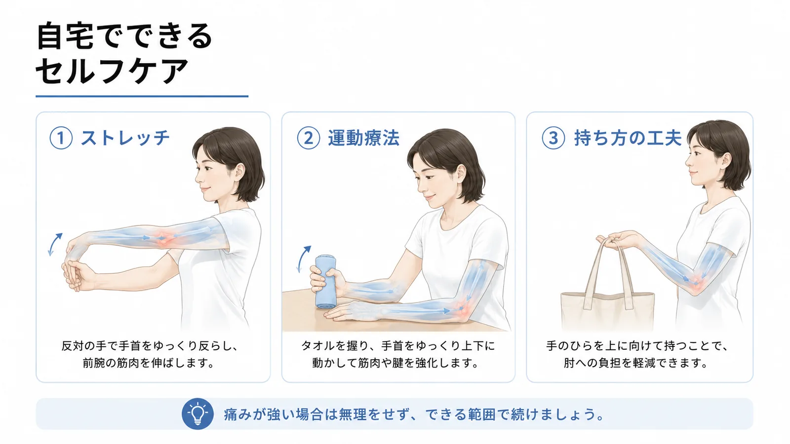テニス肘のストレッチと運動療法と荷物の持ち方を示す3つのセルフケア
