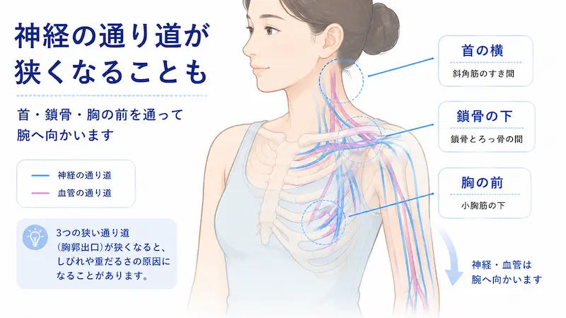 首から鎖骨まわりを通って腕へ向かう神経と血管の通り道を説明する胸郭出口症候群の図解