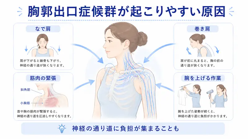 胸郭出口症候群が起こりやすい原因としてなで肩、巻き肩、首胸まわりの緊張、腕を上げる作業を説明する図解