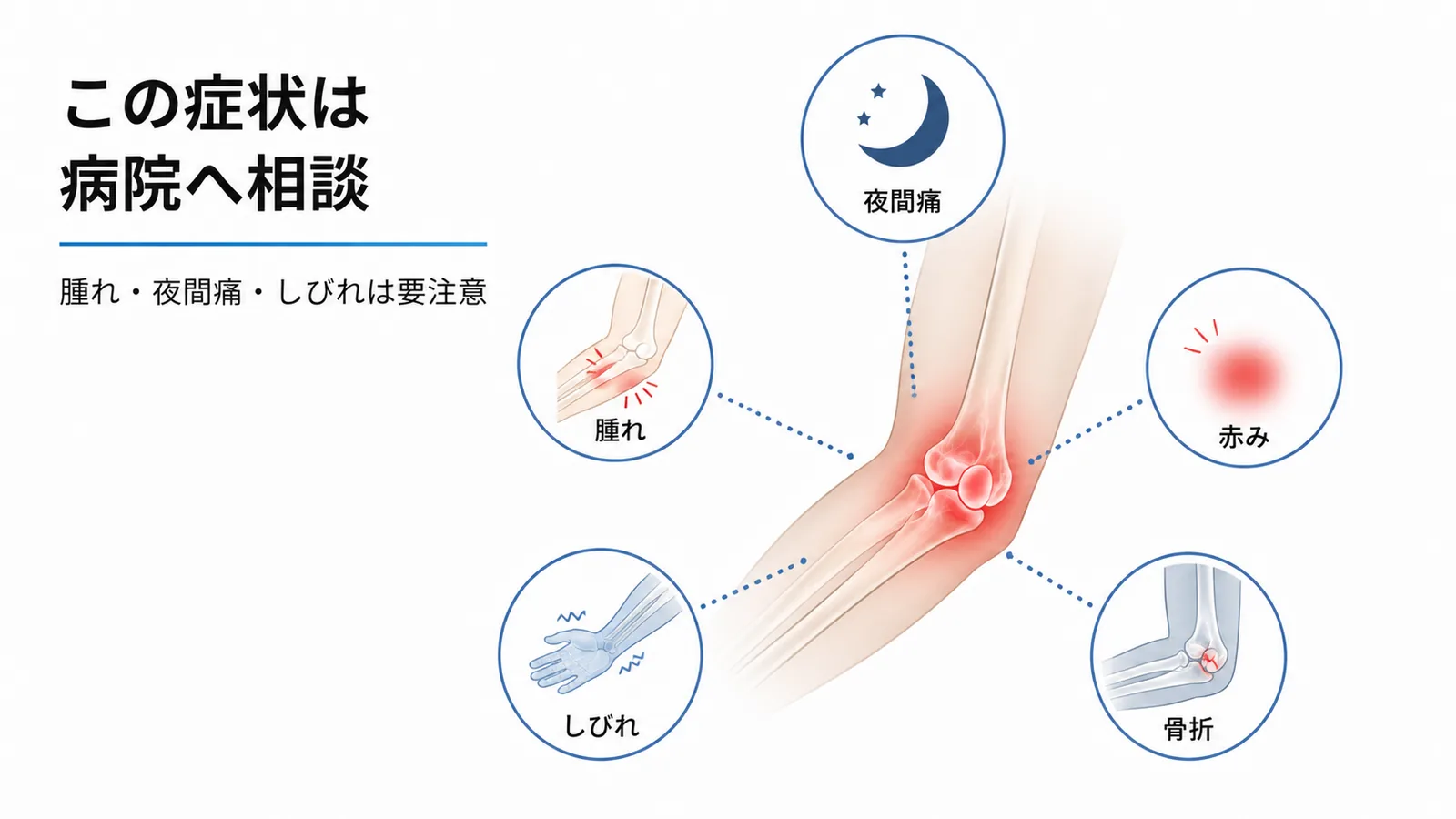 肘の腫れや夜間痛、しびれ、赤み、骨折を示す受診目安の図解