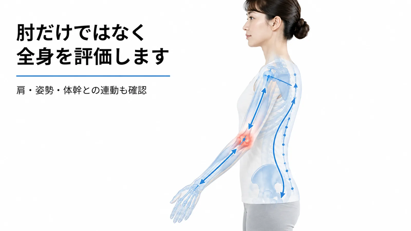 肩や体幹から手首までの連動と肘への負担を示す図解