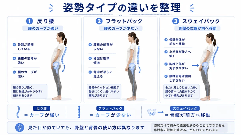 反り腰とフラットバックとスウェイバックの姿勢タイプの違いを比較した図解