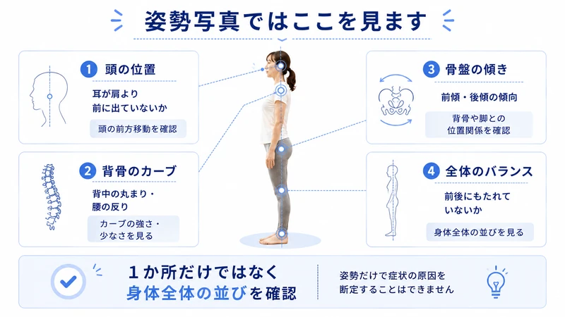 姿勢写真で確認する頭の位置背骨のカーブ骨盤の傾き全体のバランスの4項目を示した図解
