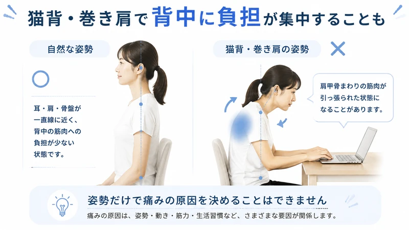 猫背や巻き肩による肩甲骨周囲の筋肉への負担を比較した図解