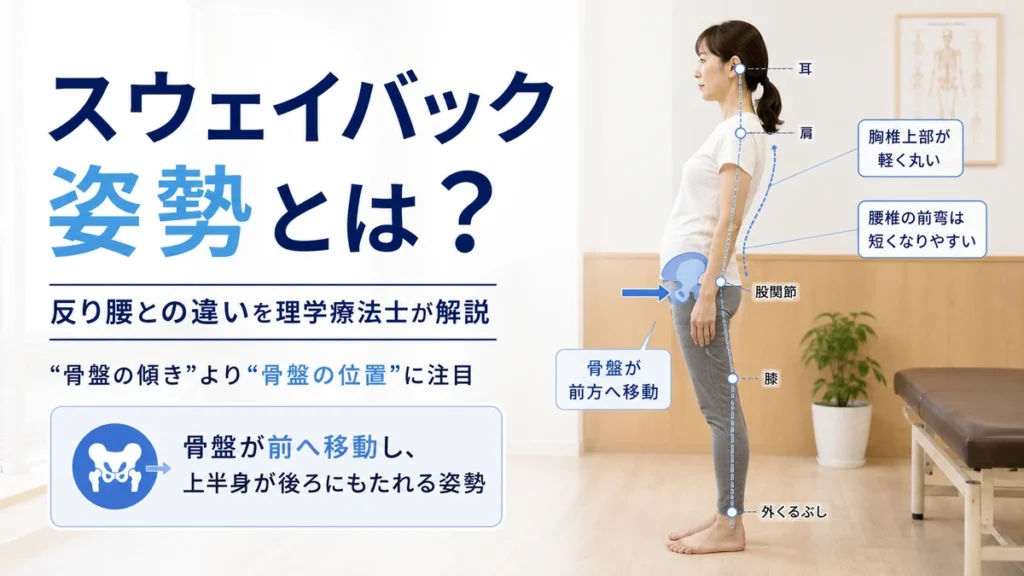 スウェイバック姿勢の特徴と反り腰との違いを理学療法士が解説する画像