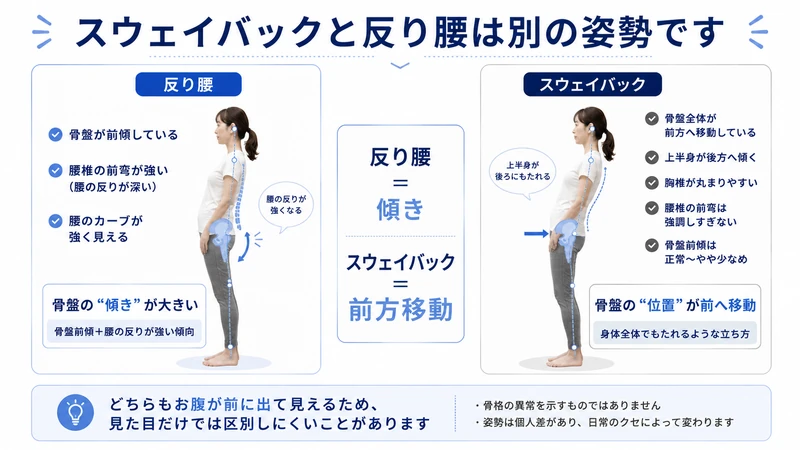 反り腰とスウェイバック姿勢の骨盤の傾きと前方移動の違いを比較した図解