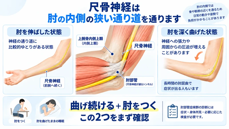 肘の内側を通る尺骨神経と肘部管の位置を肘の曲げ伸ばしで示す解剖図