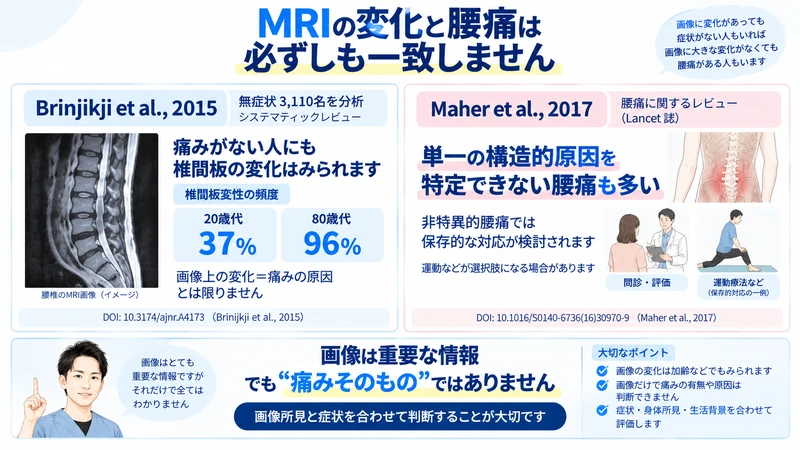 無症状者のMRI所見と非特異的腰痛に関する研究から画像と腰痛が必ずしも一致しないことを示す図解
