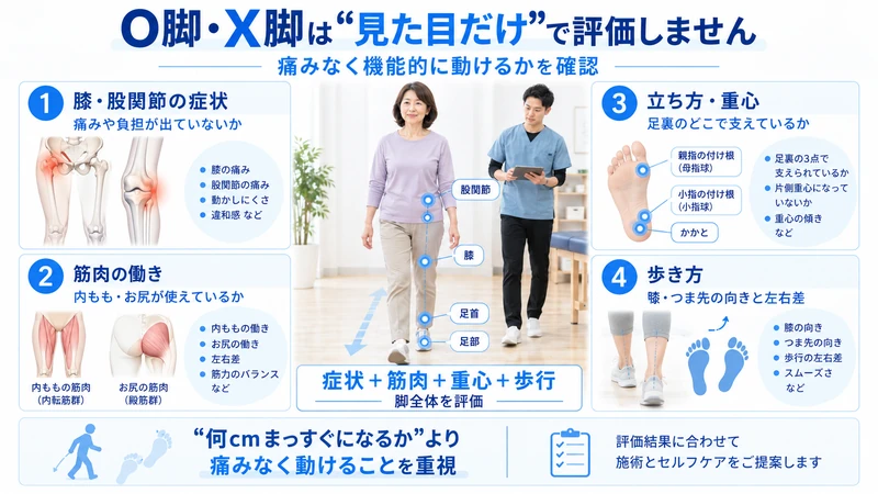 O脚X脚に対して膝股関節の症状筋肉重心歩き方を理学療法士が評価する図解