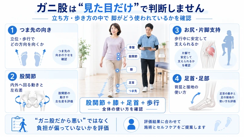 ガニ股に対してつま先股関節片脚支持足首足部を理学療法士が歩行から評価する図解