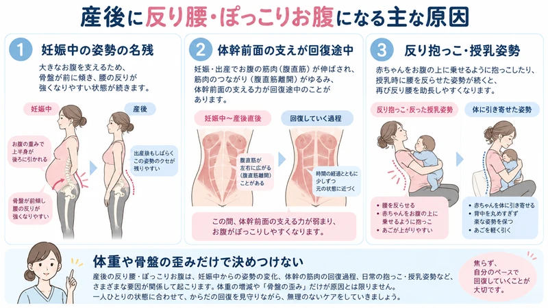 産後の反り腰に関わる妊娠中の姿勢体幹前面の支え抱っこ授乳姿勢を示す図解