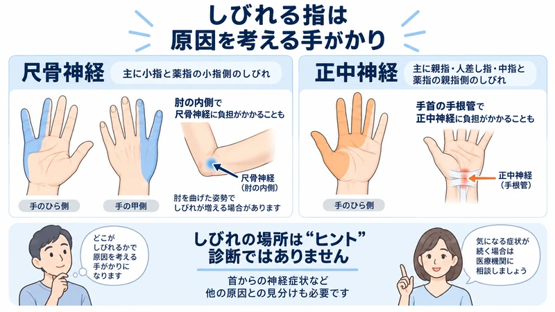 肘部管症候群の尺骨神経と手根管症候群の正中神経でしびれる指の違いを示す図解